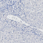 A microscope view of a human tissue.
