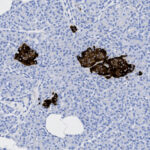 Microscopic image of tissue showing clusters of darkly stained cells against a background of smaller, lightly stained cells.