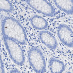 Microscopic view of stained tissue cells showing oval-shaped structures with clustered nuclei and blue cytoplasm.