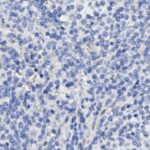 Microscopic view of numerous small, round blue cells scattered densely across a light background, typical of a histological tissue sample stained for examination.