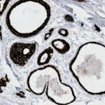 Microscopic image showing cross-sections of nerve fibers with stained myelin sheaths, displaying varying diameters and internal structures.
