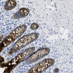 Microscopic image of intestinal tissue stained to highlight specific cell structures, showing dark brown epithelial cells and scattered blue cell nuclei.