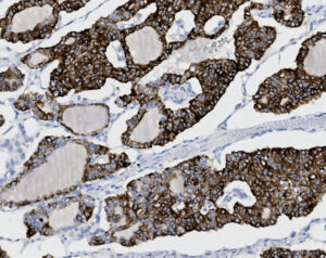 Tissue-Tek Genie<sup>&reg;</sup> anti-Cytokeratin 19