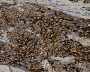 Tissue-Tek Genie<sup>&reg;</sup> anti-Cytokeratin 20