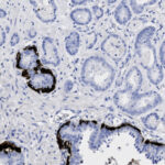 Microscopic view of tissue with dark-stained cell boundaries and light-stained interiors, showing glands or ducts in a histology slide.