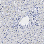 Microscopic view of liver tissue showing a cluster of cells surrounding a bile duct, with cell nuclei stained blue and scattered throughout the sample.