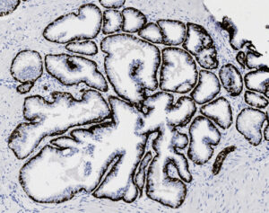 Tissue-Tek Genie<sup>&reg;</sup> anti-Cytokeratin 5/6