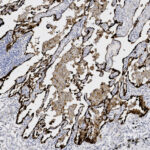 Microscopic image showing tissue stained with brown and blue dyes, highlighting cell structures and boundaries in an irregular pattern.