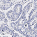 Microscopic view of tissue sample with glandular structures, stained to highlight cellular nuclei in blue and surrounding structures in lighter shades.