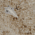 Microscopic view of stained liver tissue showing polygonal cells with brown-stained cytoplasm and scattered blue nuclei, highlighting cellular structure and tissue organization.