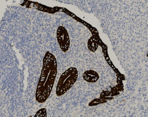 Tissue-Tek Genie<sup>&reg;</sup> anti-Cytokeratin 8