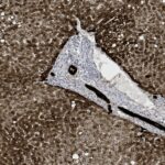 Microscopic image showing a brown-stained tissue section with a central irregularly shaped lighter area and scattered dark spots throughout.