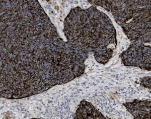 Tissue-Tek Genie<sup>&reg;</sup> anti-Cytokeratin Antibody Cocktail [AE1/AE3]