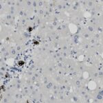 Microscopic image of liver tissue showing scattered cells and vacuoles, some areas stained darker, indicating cellular structures and possible abnormalities.