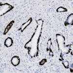 Microscopic image of tissue showing glandular structures with dark-stained epithelial cell linings and surrounding lighter stroma, viewed under a microscope.