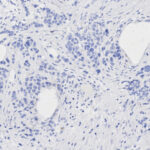 Microscopic image showing clusters of dark-stained cell nuclei and several irregularly shaped empty spaces in a pale-stained tissue section.