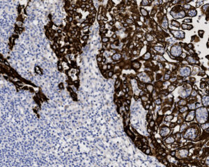 Tissue-Tek Genie<sup>&reg;</sup> anti-Cytokeratin HMW (CK5)
