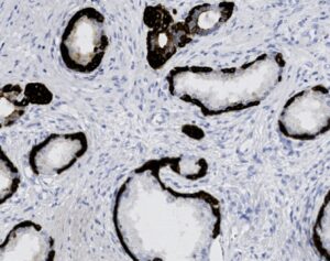 Tissue-Tek Genie<sup>&reg;</sup> anti-Cytokeratin HMW