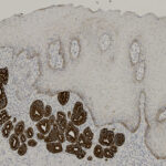 Microscopic image of tissue section showing glandular structures stained brown and surrounding cells stained light blue, illustrating cellular organization and contrast.