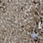Microscopic view of stained tissue cells with varying shades of brown and blue, showing cell nuclei and structural details.