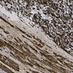 Microscopic image showing dense clusters of dark-stained cells in the upper area and elongated, fiber-like structures in the lower area.