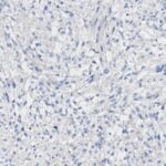 Microscopic view of tissue sample with scattered pale blue and purple stained cells on a light background.