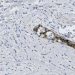Microscopic image showing a tissue sample with brown-stained cells along a structure, indicating positive immunohistochemical staining against a mostly light blue background.