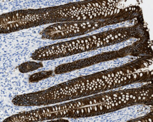 Tissue-Tek Genie<sup>&reg;</sup> anti-Epithelial Cell Adhesion Molecule