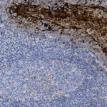 Microscopic image showing brown-stained neural tissue adjacent to densely packed blue-stained cells, likely representing an immunohistochemical analysis of a tissue section.