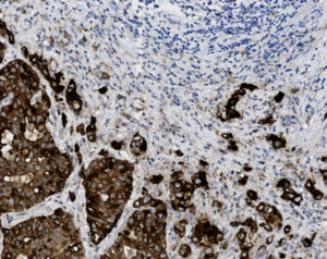Tissue-Tek Genie<sup>&reg;</sup> anti-Epithelial&nbsp;Membrane Antigen