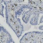 Microscopic view of tissue sections with blue-stained cells and scattered brown nuclei, indicating immunohistochemical staining.
