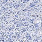 Microscopic image showing elongated blue-stained nuclei scattered within a pale, fibrous tissue background, typical of a histology slide.