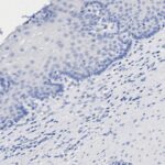 Microscopic image showing clusters of stained cells with varying density and distribution across the tissue sample.
