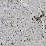 Microscopic view of tissue sample stained to highlight specific cellular structures; round blue shapes indicate cell nuclei, and brown areas show marked features.