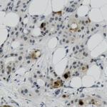 Microscopic image shows a tissue sample with round, white adipocyte cells and darker stained cell nuclei scattered throughout the background.
