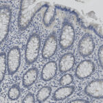 Microscopic view of a tissue section showing oval-shaped glandular structures with densely packed dark-stained nuclei and lighter cytoplasmic areas.