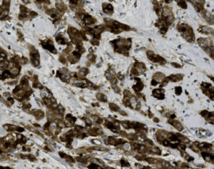 Tissue-Tek Genie<sup>&reg;</sup> anti-GCDFP-15