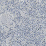 Microscopic view of tissue section showing numerous small, evenly distributed blue-stained cell nuclei on a pale background.