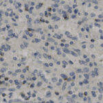 Microscopic image showing numerous blue-stained nuclei of cells scattered across a light background, likely from a tissue sample stained with hematoxylin.