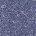 Microscopic view of densely packed blue-stained cells, likely indicating lymphoid tissue or a cellular sample under high magnification.