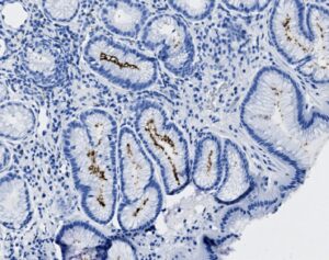 Tissue-Tek Genie<sup>&reg;</sup> anti-Helicobacter pylori