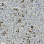 Microscopic image showing numerous small, dark brown-stained cells scattered among larger pale cells, indicating immunohistochemical staining within tissue.