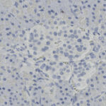 Microscopic image showing clusters of pancreatic islet cells with dark-stained nuclei among lighter-stained surrounding tissue.