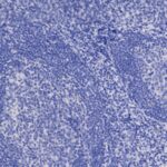 Microscopic view of densely packed blue-stained cells clustered together, possibly illustrating tissue or cell samples under a microscope.