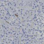Microscopic image showing many small, round, blue-stained cell nuclei scattered throughout tissue with a few darker brown-stained spots.