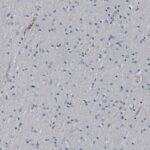 Microscopic view of brain tissue showing numerous small, round cells with dark nuclei scattered across a pale background.