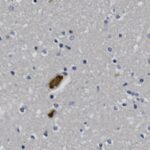 Microscopic image showing scattered blue-stained cell nuclei and a few irregular brown deposits on a pale background.
