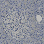 Microscopic image of pancreatic tissue showing a lighter-stained islet of Langerhans surrounded by darker-stained exocrine cells; cell nuclei are visible as dark dots.