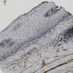Microscopic view of a tissue section stained to highlight cell nuclei in blue and certain structures in brown, showing layered cellular organization.