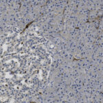 Microscopic image of tissue section stained to show cell nuclei in blue and other cellular components in brown; clusters of cells are visible throughout the sample.